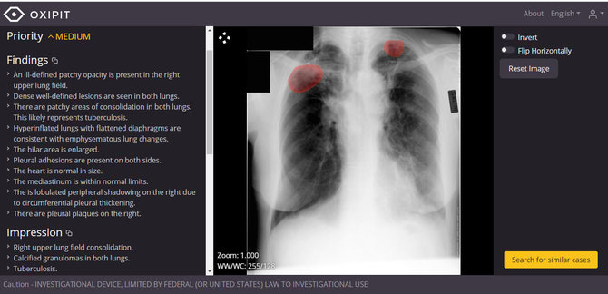 Bendrovės nuotr./„Oxipit“ programinė įranga, pasikinkiusi dirbtinį intelektą, atpažįsta patologiniuis pakitimus rentgenologiniuose vaizduose