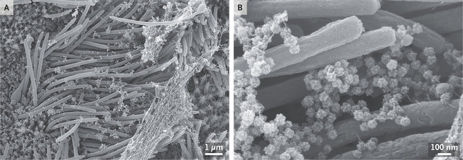 C.Ehre nuotr./Nespalvotose SARS-CoV-2 nuotraukose – daugiau mokslininkams reikalingo kontrastingumo