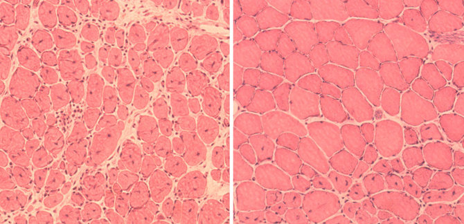 Salko instituto nuotr./Pelės raumenų ląstelės: kairėje – be senatvės gydymo, dešinėje – po gydymo