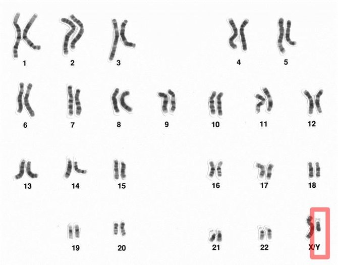 National Human Genome Research Institute nuotr./Žmogaus chromosomos. 23 poroje raudonai apibraukta Y chromosoma, lemianti vyrišką lytį