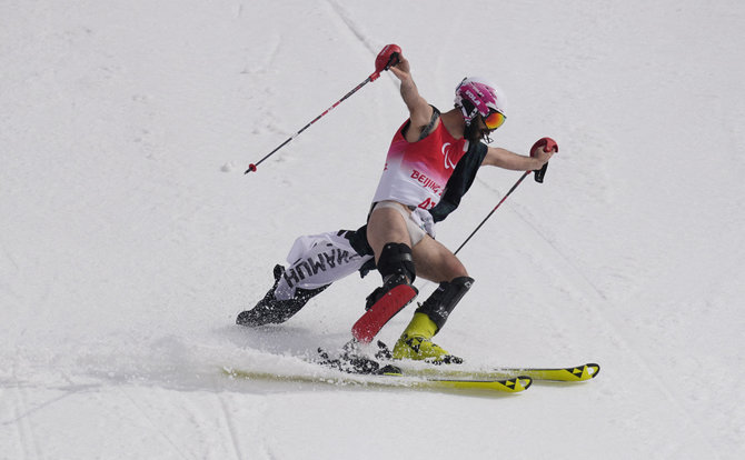 „Reuters“/„Scanpix“ nuotr./Manoelis Bourdenx tokiu būdu siekė atkreipti dėmesį į nelygybę tarp olimpinių ir paralimpinių žaidynių.