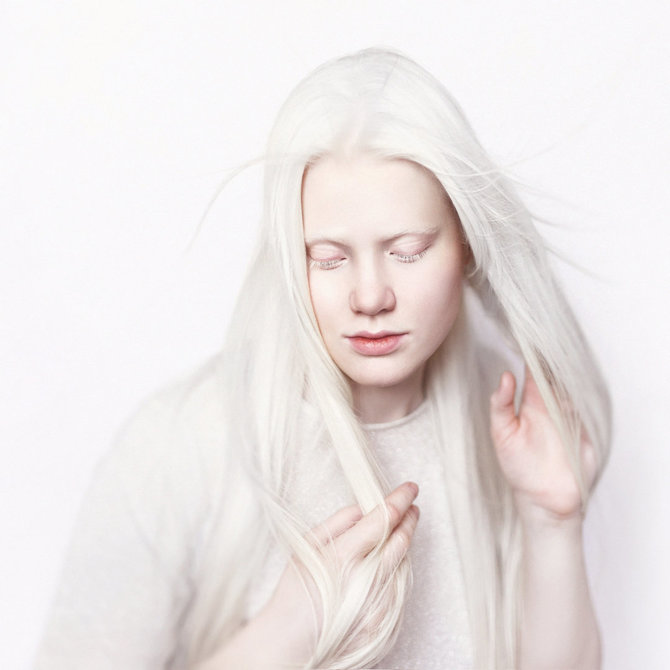 123RF.com nuotr./Mergina albinosė