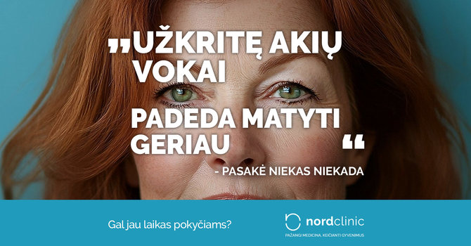 „Nordclinic“ nuotr./„Užkritę akių vokai padeda matyti geriau“