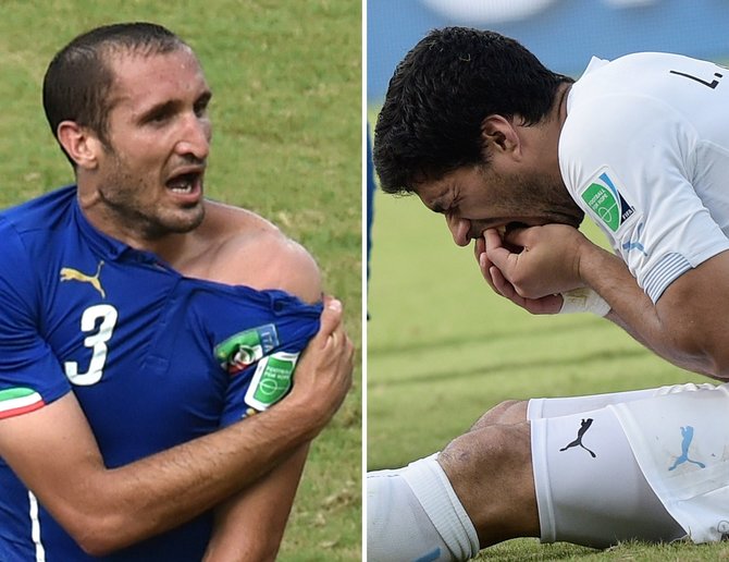 „Scanpix“ nuotr./Luisas Suarezas įkando italui Giorgio Chiellini per 2014 metų FIFA pasaulio futbolo čempionatą