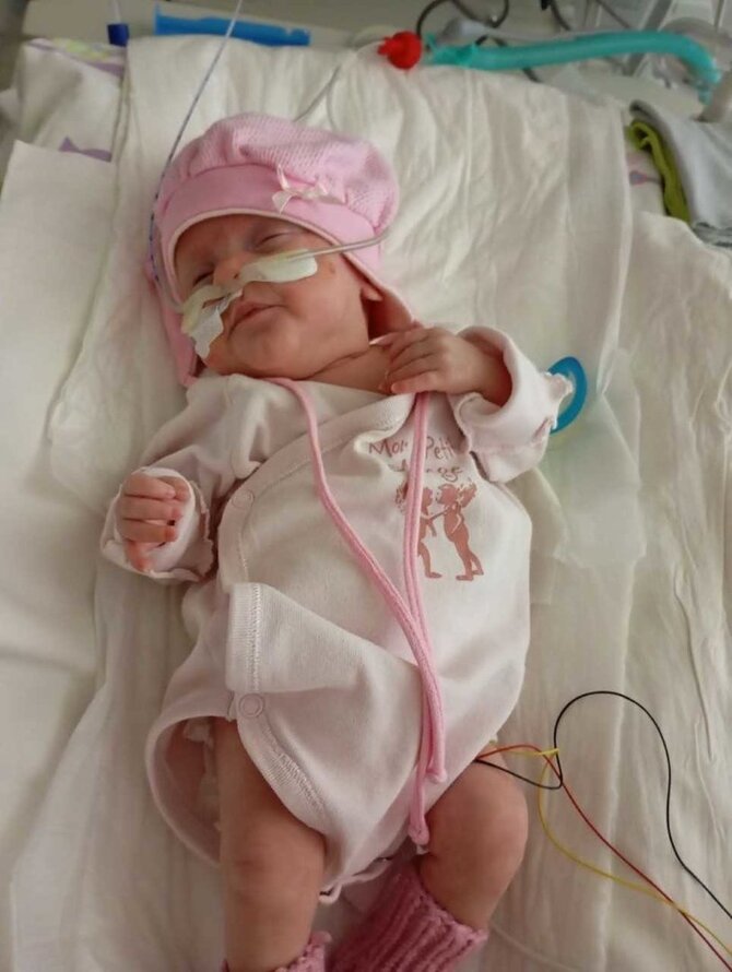 Kauno klinikų nuotr. /Klaudija gimė 22 savaičių ir 390 gramų svorio 