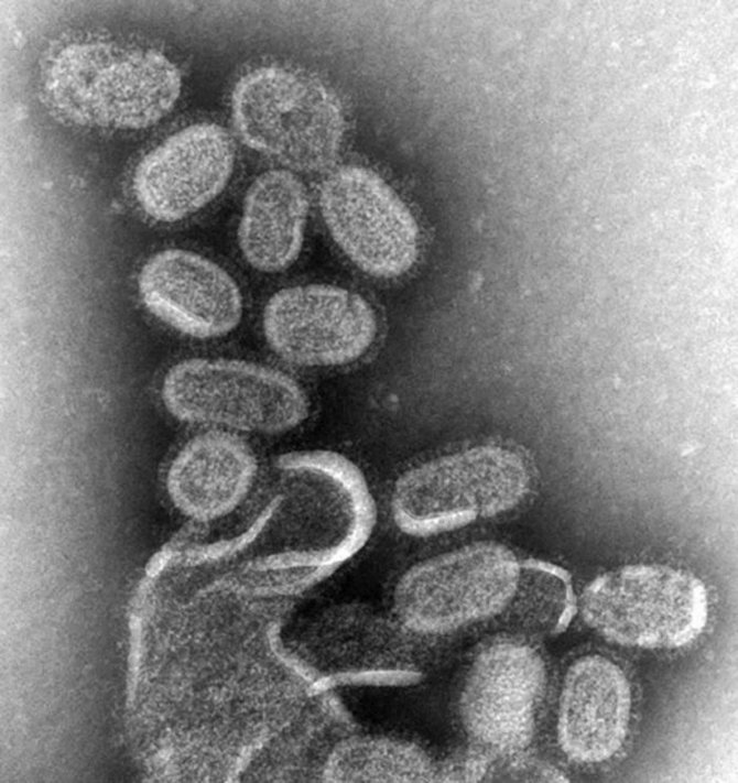 Wikipedia.org nuotr. /Ispaniškojo gripo virusas per mikroskopą.
