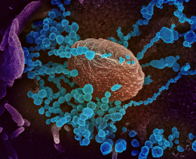 AFP/„Scanpix“ nuotr./Skenuojančio elektroninio mikroskopo užfiksuotas vaizdas: naujojo koronaviruso kūneliai (mėlyni) veržiasi iš laboratorijoje užkrėstos ląstelės
