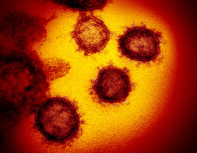 „Scanpix“/AP nuotr./Elektroniniu mikroskopu užfiksuotas koronaviruso vaizdas