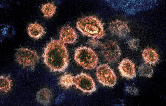 „Scanpix“/AP nuotr./Koronavirusas