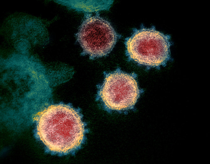 „Scanpix“ nuotr./Naujasis koronavirusas