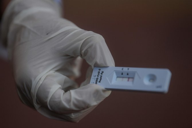 AFP/„Scanpix“ nuotr./Greitasis antigenų testas