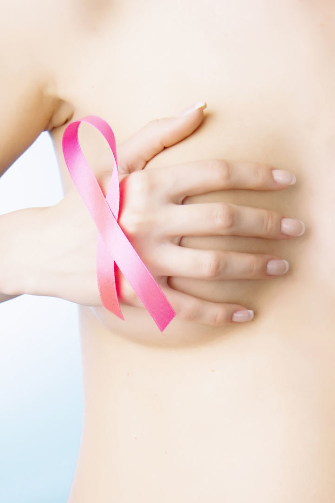 „Shutterstock“ nuotr./Krūties vėžys