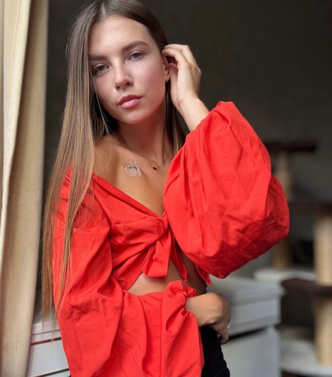 Asmeninė nuotr./Alina Tombaj jau po operacijos