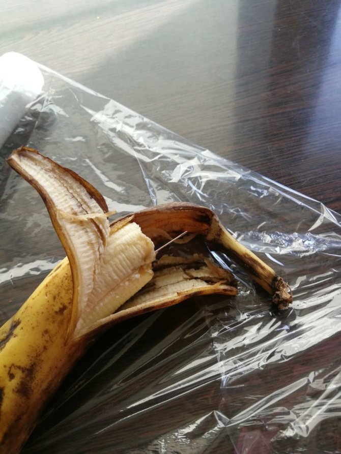 Skaitytojos Daivos nuotr./Parduotuvėje Raudondvaryje pirktame banane aptikta adata