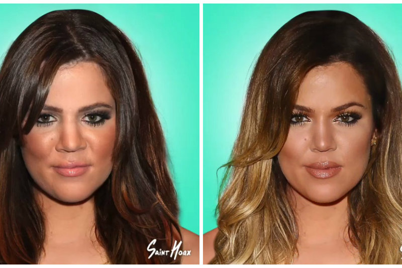 Khloe Kardashian išvaizdos pokyčiai