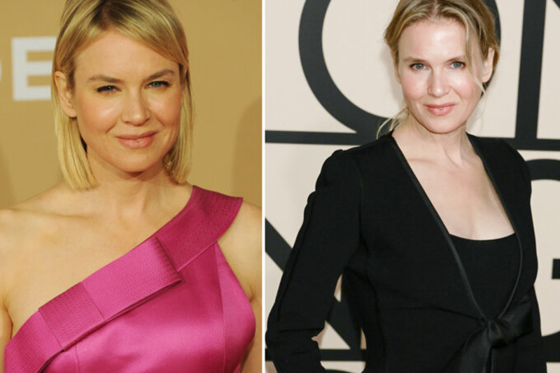 Aktorė Renee Zellweger