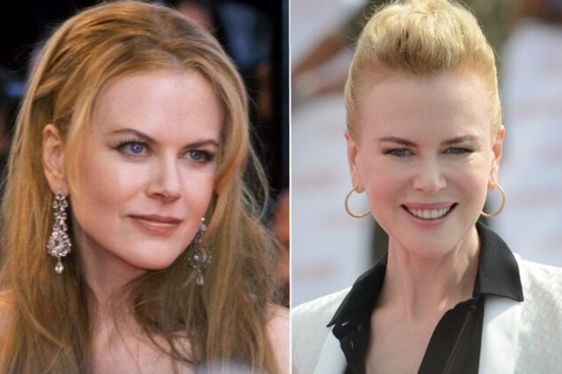 Nicole Kidman 2001-aisiais ir dabar