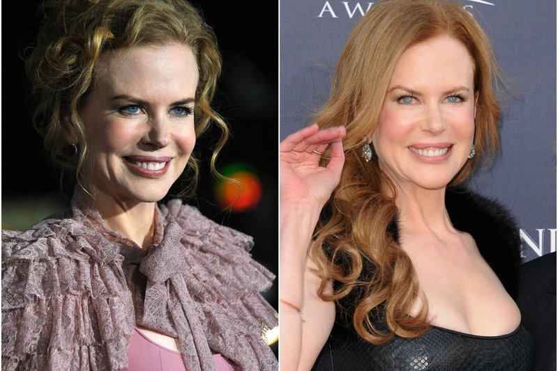 Nicole Kidman 2009 (kairėje) ir 2011 metais.