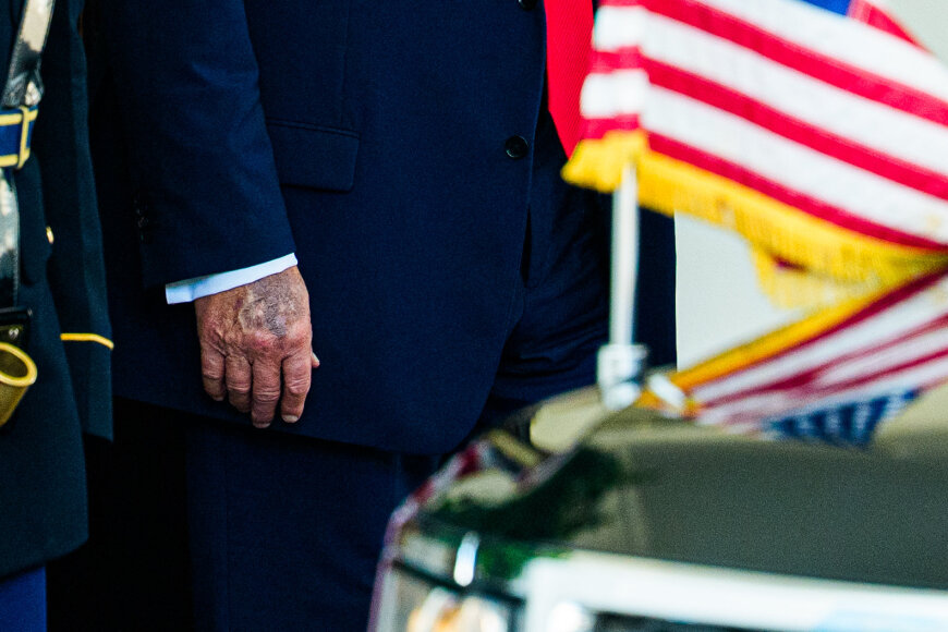 Vida Press nuotr./Ant D.Trumpo rankos matoma kraujosruva