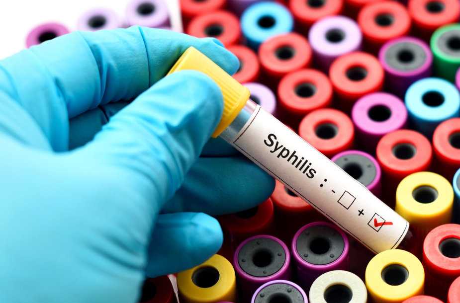 Sifilio tyrimas