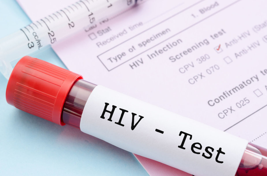 ŽIV testas