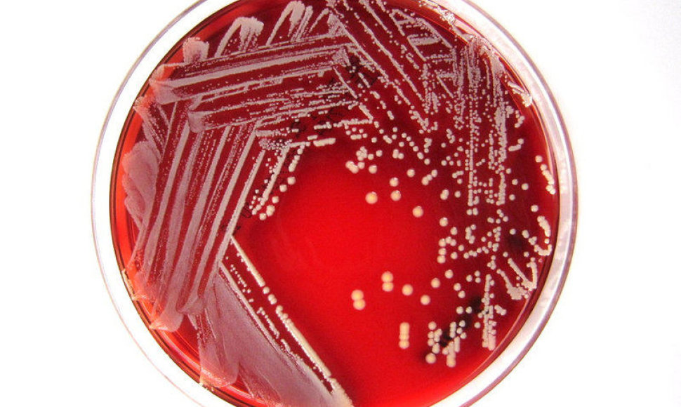 Staphylococcus lugdunensis bakterija