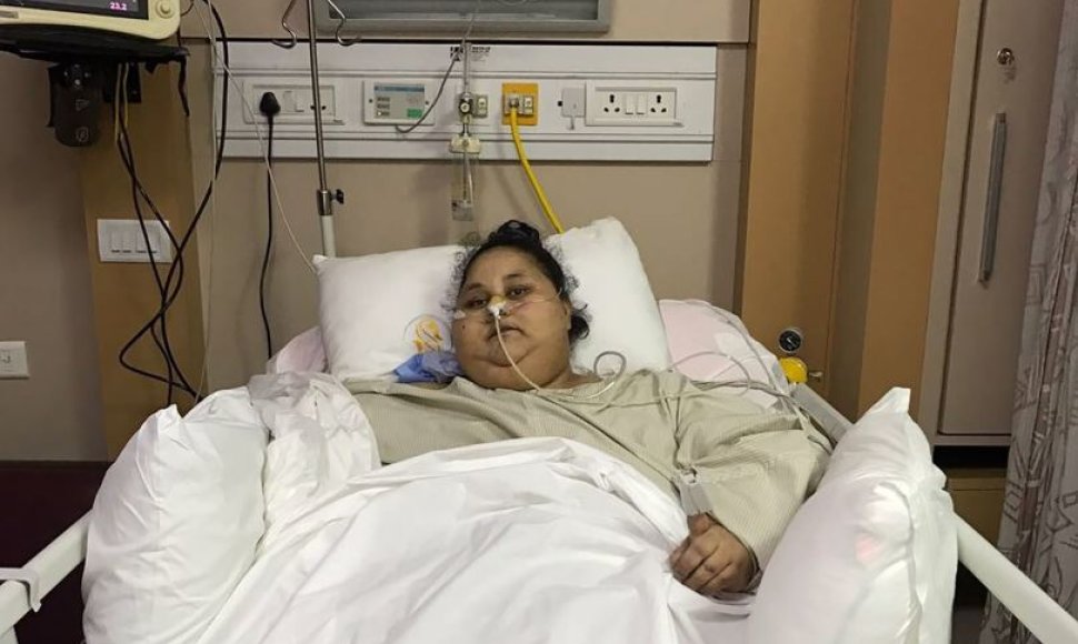 „Sunkiausiai pasaulio moteriai“ Indijoje atlikta skrandžio mažinimo operacija