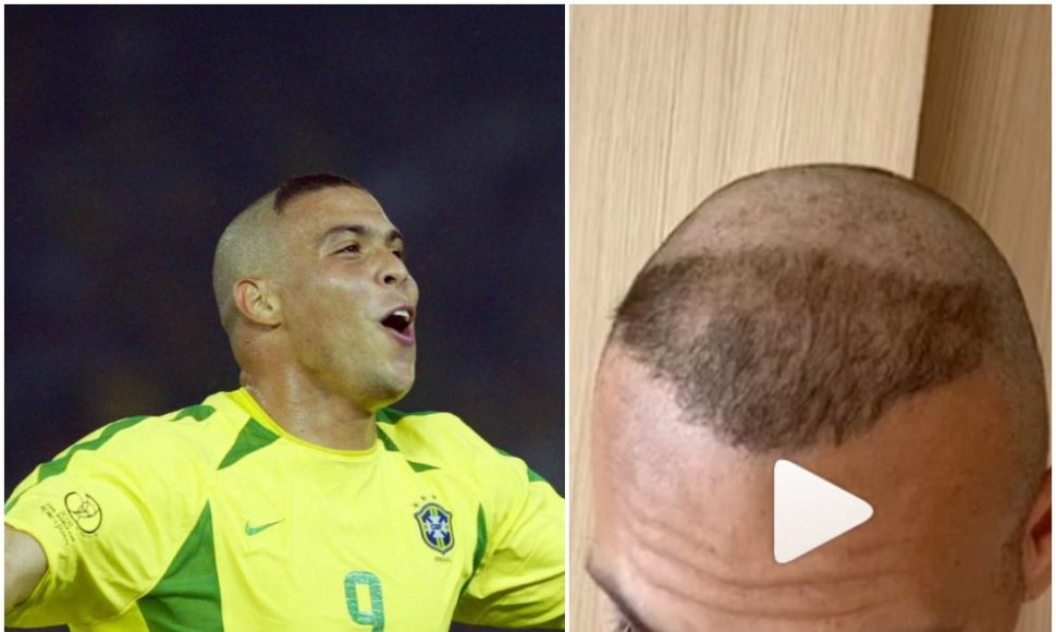 Martinas Braithwaite'as nukopijavo Ronaldo šukuoseną.