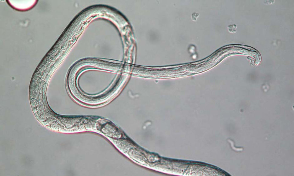 Strongyloides stercoralis, mastelio žymeklio dydis – 30 mikrometrų