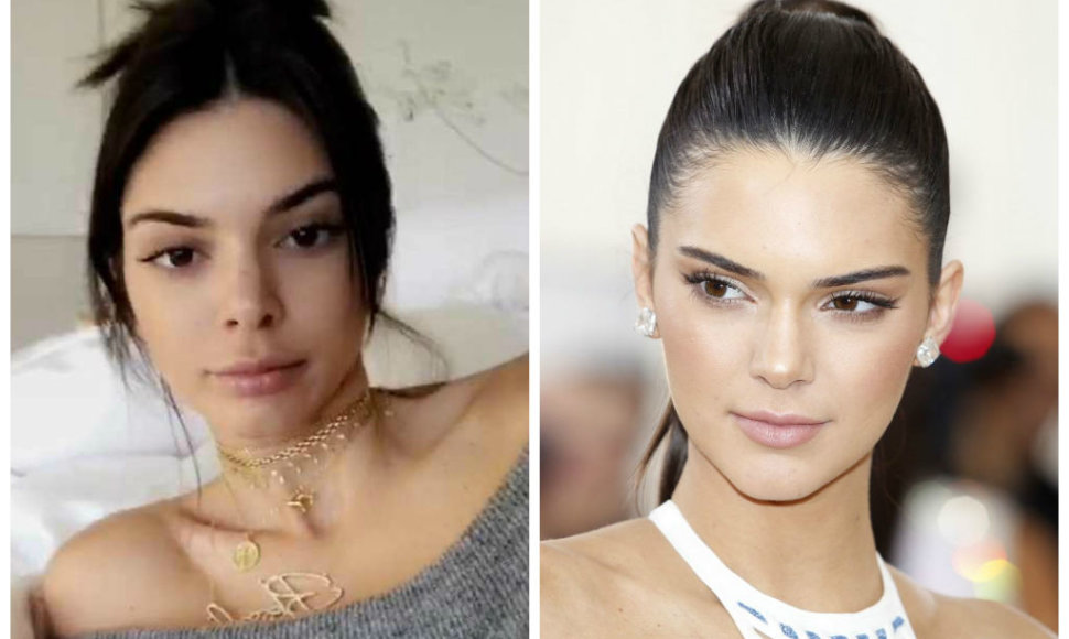 Kendall Jenner dabar ir anksčiau