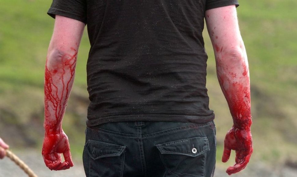 Vyras kruvinomis rankomis