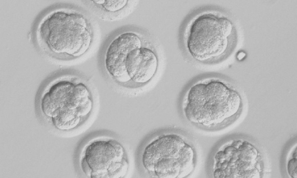 Besivystantys žmogaus embrionai, kuriuose panaudota DNR iš odos ląstelių, trečiąją vystymosi dieną. 