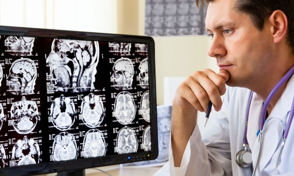Daktaras žiūri į galvos rentgeno nuotraukas