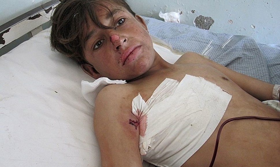 Per NATO antskrydį sužeistas civilis berniukas