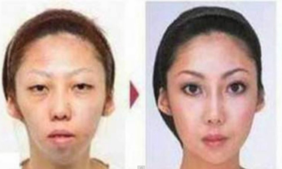 Jian Fengo žmona prieš ir po plastinių operacijų