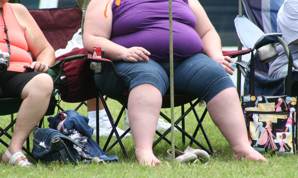 Nutukimas šiuo metu tampa didelė problema