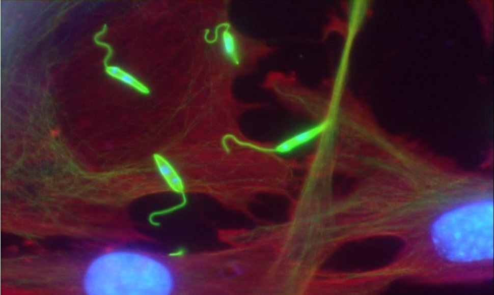 Leishmania major (žalia spalva) šeimininko ląstelėse (raudona spalva žymi citoplazmą, mėlyna – branduolius)