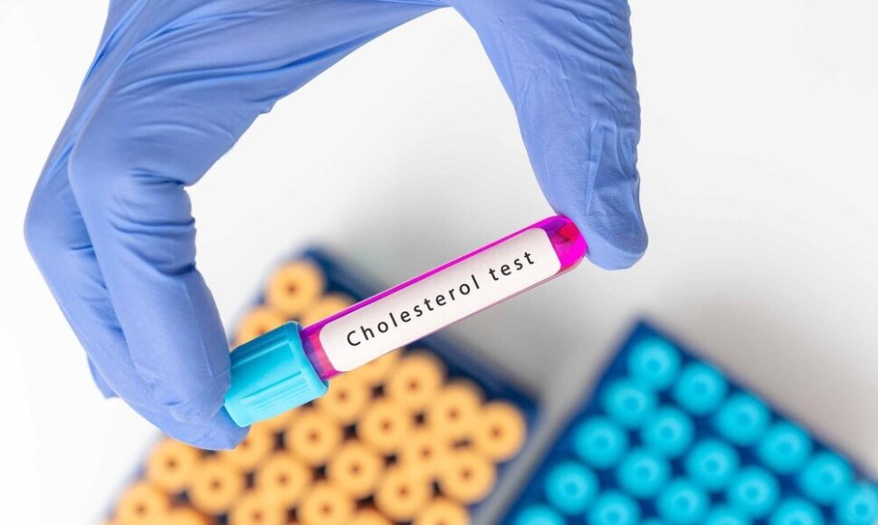 Cholesterolis