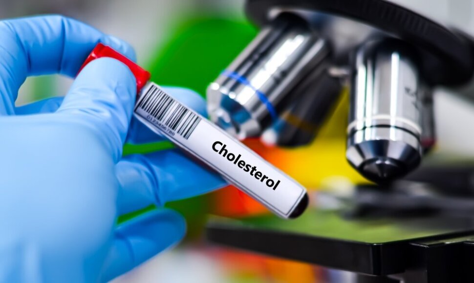Blogasis cholesterolis