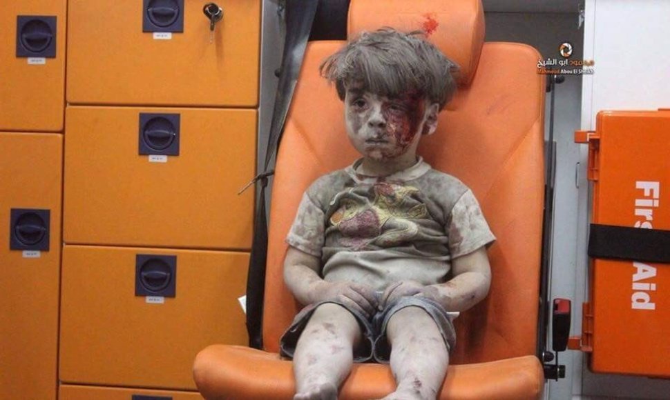Sužeistas penkiametis Alepe