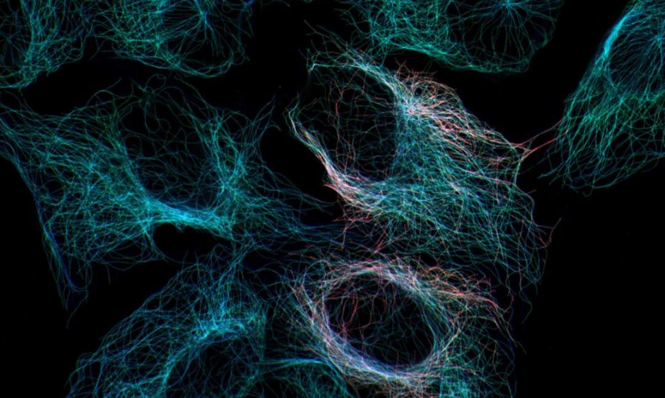 „Daug mažų vaiduoklių“. Nuotraukoje matomas tubulino tinklas, kuris yra vienas iš ląstelės formą palaikančio citoskeleto komponentų.