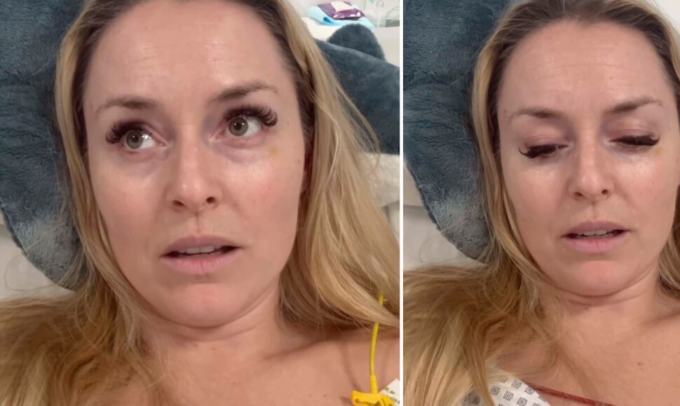 Lindsey Vonn įrašu instagrame pasidalino naujienos apie laukiančias operacijas.