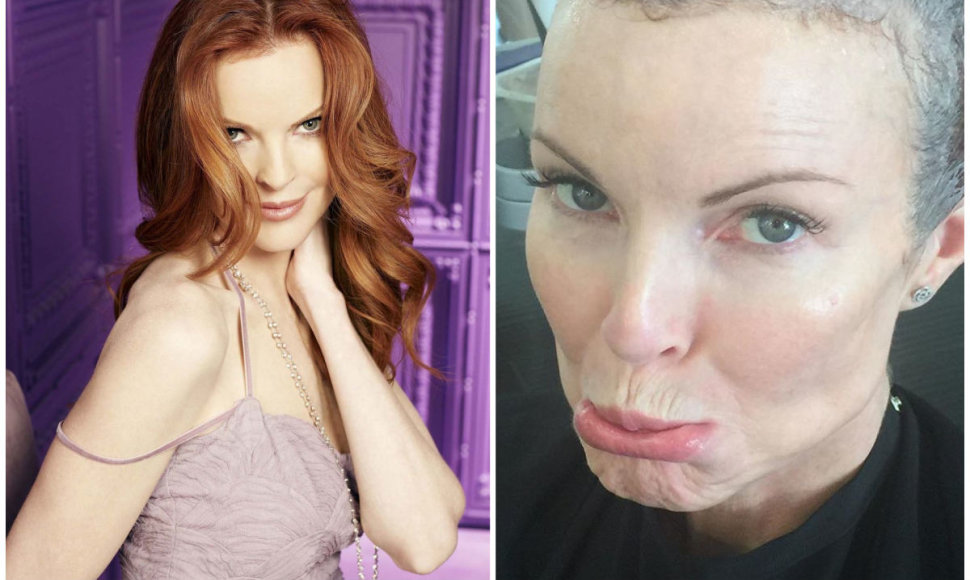 „Nusivylusių namų šeimininkių“ žvaigždė Marcia Cross išsigydė vėžį