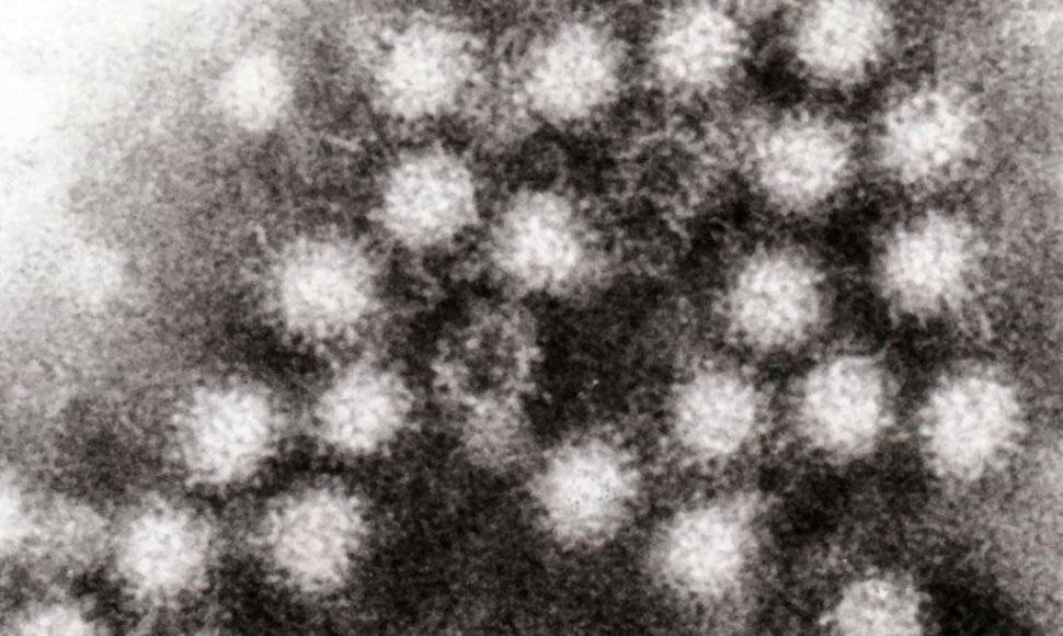 Norovirusas