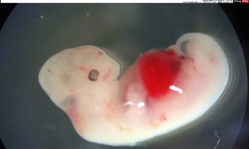 Žmogaus ir kiaulės chimeros embrionas