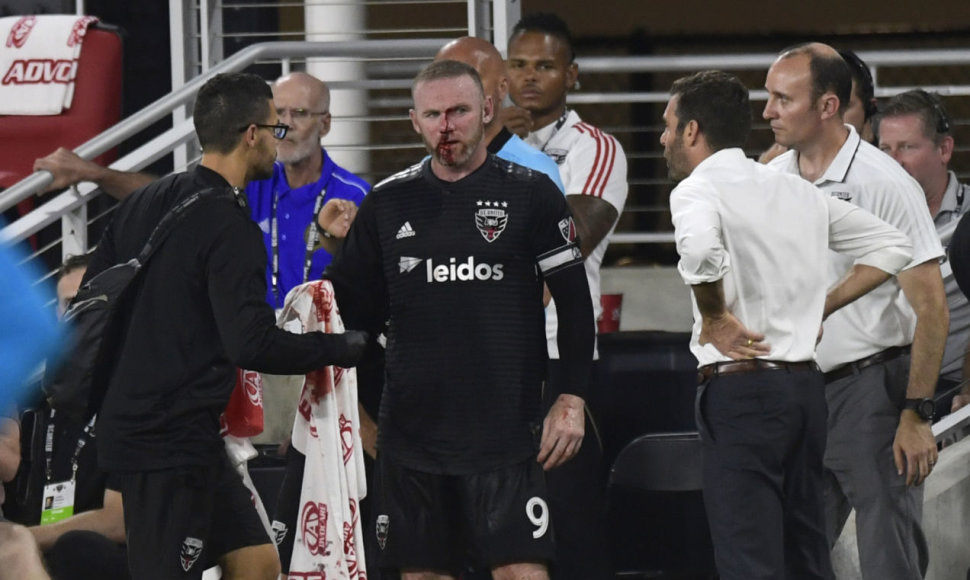 Wayne'as Rooney per JAV lygos rungtynes patyrė nosies lūžį.