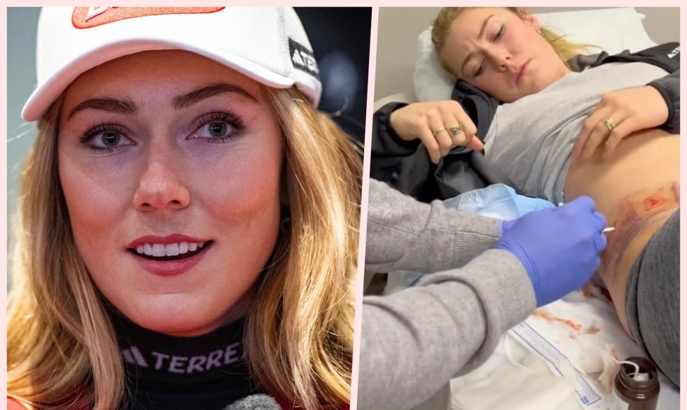 Mikaela Shiffrin susižeidė per kalnų slidinėjimo pasaulio taurės varžybas JAV.