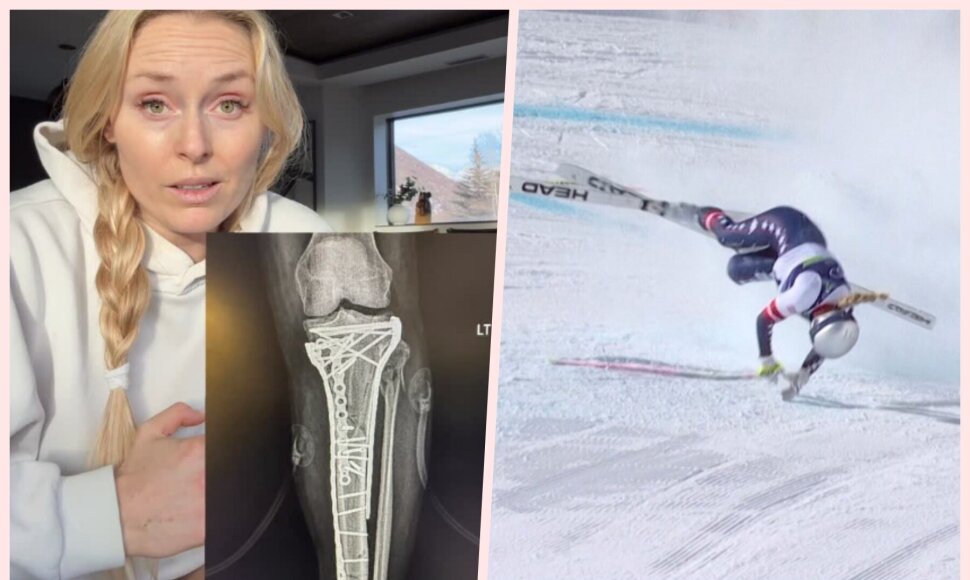 Lindsey Vonn sveiksta po siaubingo kritimo Milano-Kortinos žaidynėse.