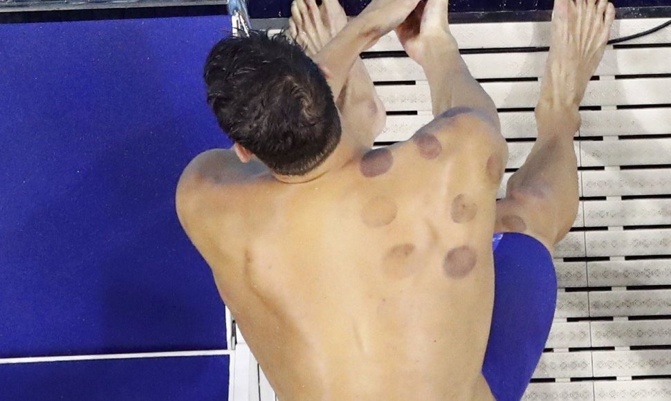 Dėmės ant M.Phelpso nugaros