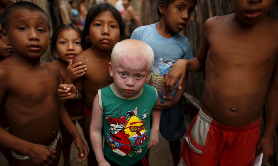 Kunų genties albinosai